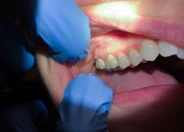 Best Weekend Emergency Dentist in Dacula, GA