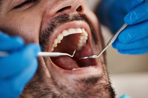 Best Pediatric Emergency Dentist in Dacula, GA
